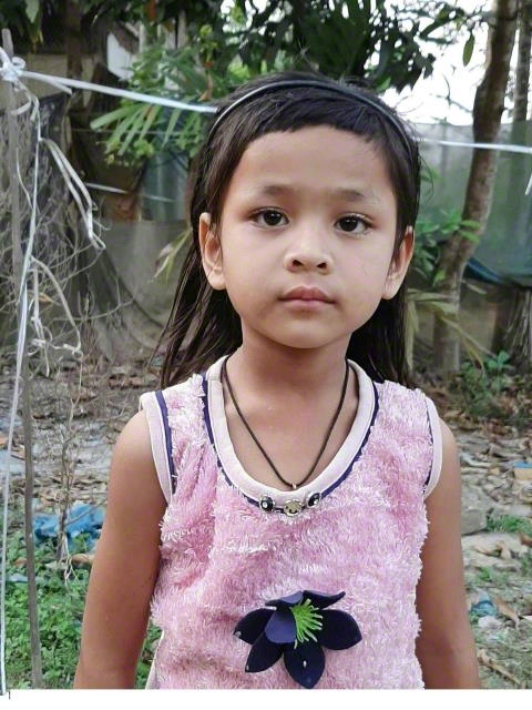 World Vision India